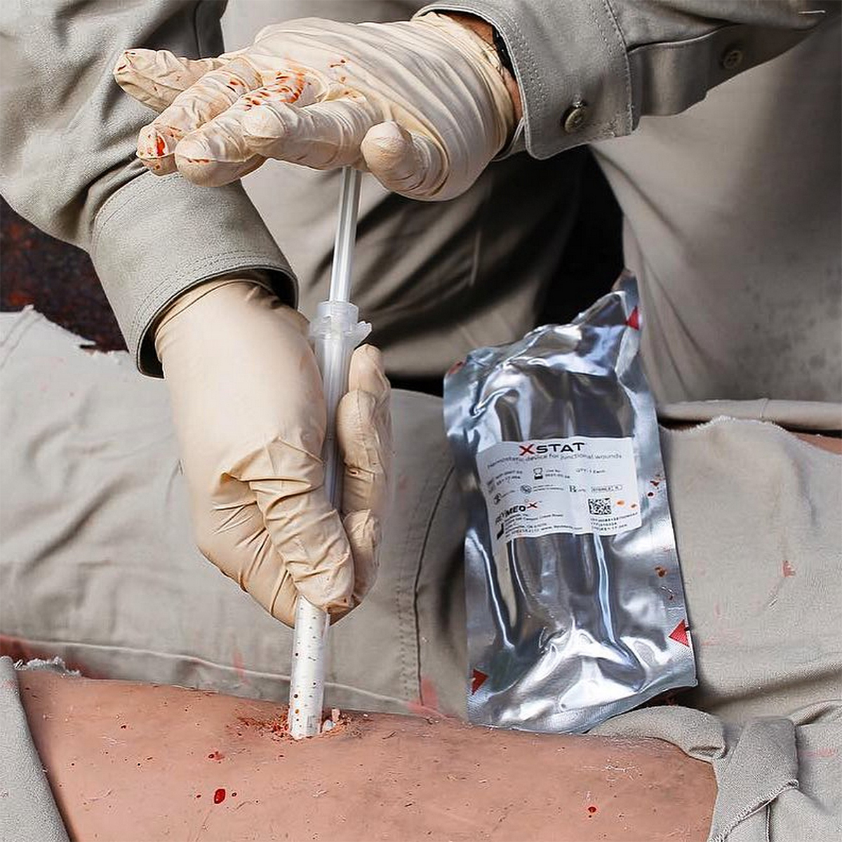 Введення кровоспинного засобу XSTAT за допомогою аплікатора в глибоку рану